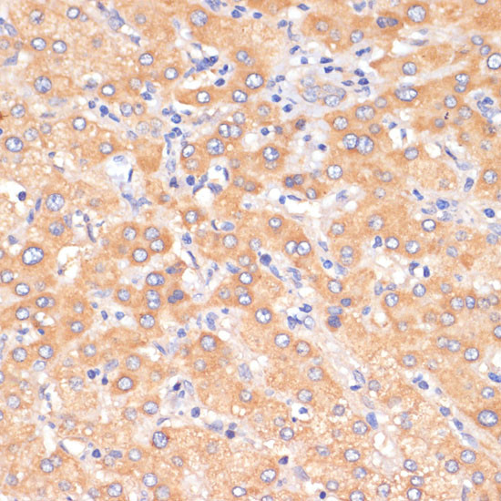 PDCD2L Antibody in Immunohistochemistry (Paraffin) (IHC (P))