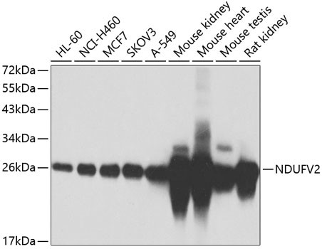 NDUFV2 Antibody in Western Blot (WB)