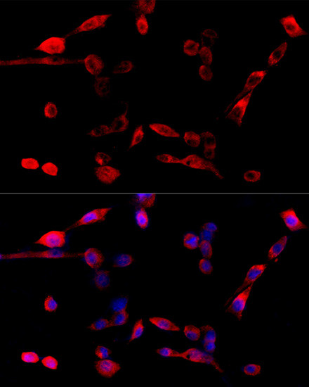 Tug Antibody in Immunocytochemistry (ICC/IF)