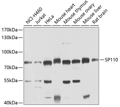SP110 Antibody in Western Blot (WB)