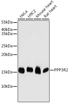 PPP3R2 Antibody in Western Blot (WB)