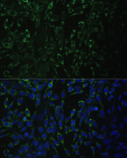ALDH1A2 Antibody in Immunocytochemistry (ICC/IF)