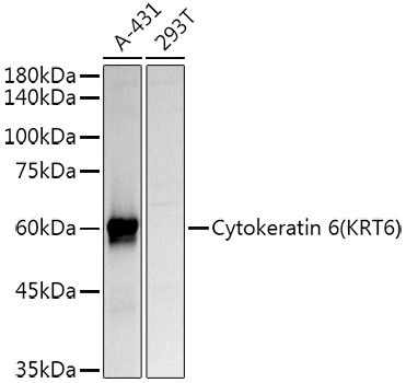 Cytokeratin 6A Antibody in Western Blot (WB)