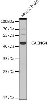 CACNG4 Antibody in Western Blot (WB)