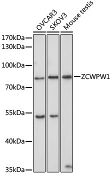 ZCWPW1 Antibody in Western Blot (WB)