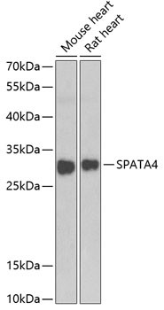 SPATA4 Antibody in Western Blot (WB)
