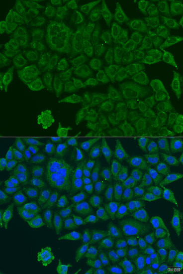 BCS1L Antibody in Immunocytochemistry (ICC/IF)
