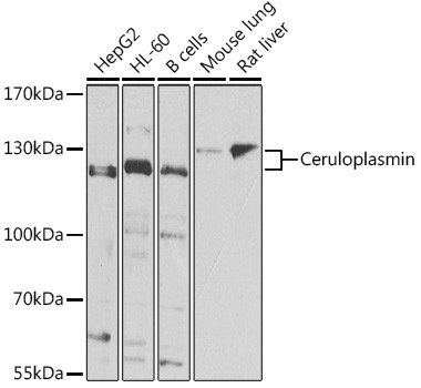 Ceruloplasmin Antibody in Western Blot (WB)