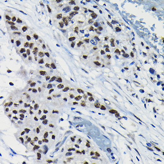 DRIL1 Antibody in Immunohistochemistry (Paraffin) (IHC (P))