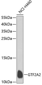 GTF2A2 Antibody in Western Blot (WB)