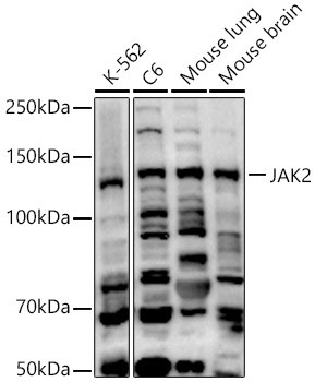 JAK2 Antibody in Western Blot (WB)
