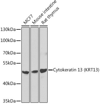 Cytokeratin 13 Antibody in Western Blot (WB)