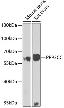 PPP3CC Antibody in Western Blot (WB)