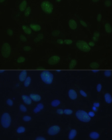 DNA-PK Antibody in Immunocytochemistry (ICC/IF)