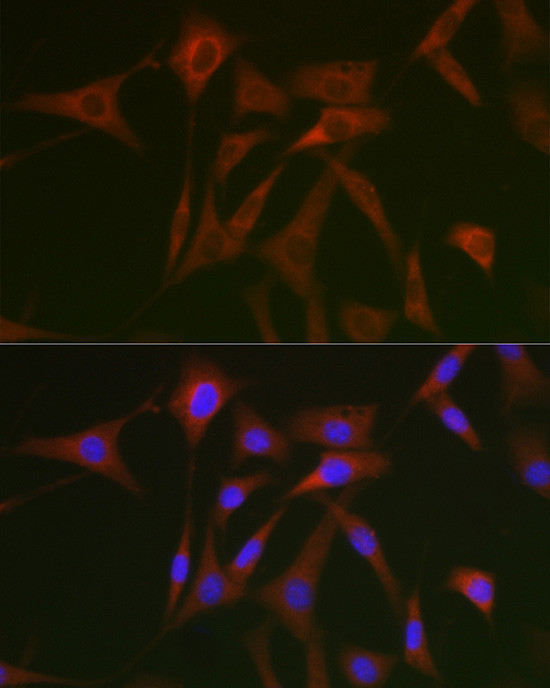 STAT5 alpha Antibody in Immunocytochemistry (ICC/IF)
