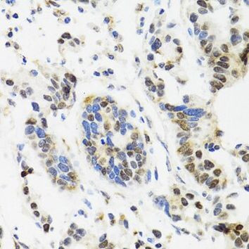 TOP1 Antibody in Immunohistochemistry (Paraffin) (IHC (P))