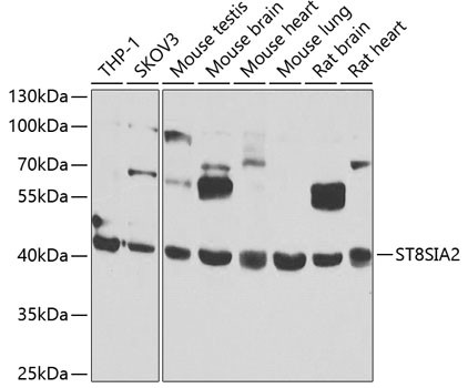 ST8SIA2 Antibody in Western Blot (WB)