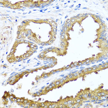 NCK2 Antibody in Immunohistochemistry (Paraffin) (IHC (P))