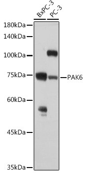 PAK6 Antibody in Western Blot (WB)