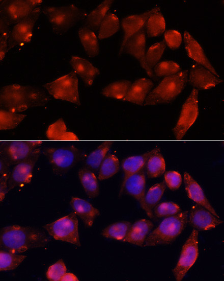 ACVR2B Antibody in Immunocytochemistry (ICC/IF)