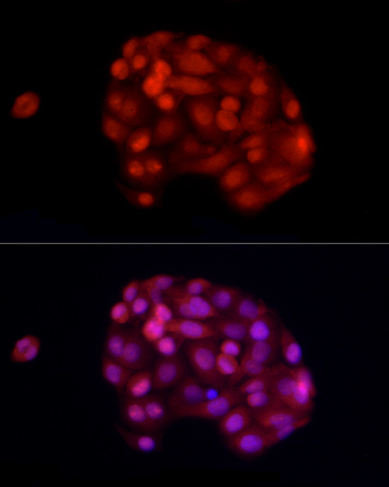 ADAR Antibody in Immunocytochemistry (ICC/IF)