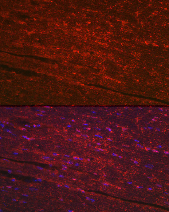 PGAM2 Antibody in Immunohistochemistry (Paraffin) (IHC (P))