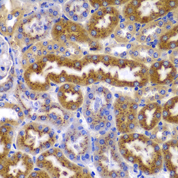 AMPK beta-1 Antibody in Immunohistochemistry (Paraffin) (IHC (P))