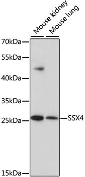 SSX4 Antibody in Western Blot (WB)