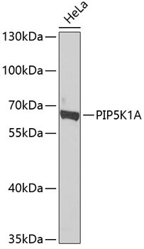 PIP5K1A Antibody in Western Blot (WB)