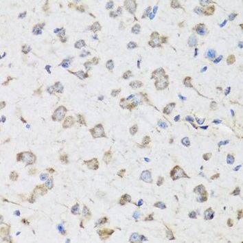 USP25 Antibody in Immunohistochemistry (Paraffin) (IHC (P))