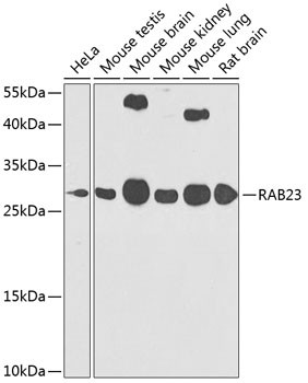 RAB23 Antibody in Western Blot (WB)