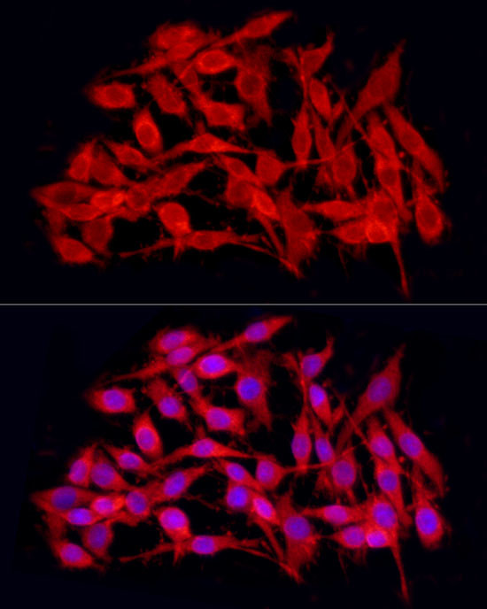 JMJD4 Antibody in Immunocytochemistry (ICC/IF)