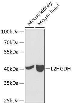 L2HGDH Antibody in Western Blot (WB)