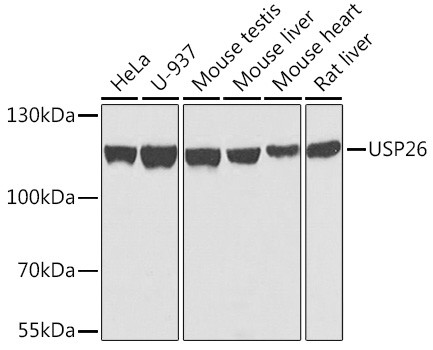 USP26 Antibody in Western Blot (WB)