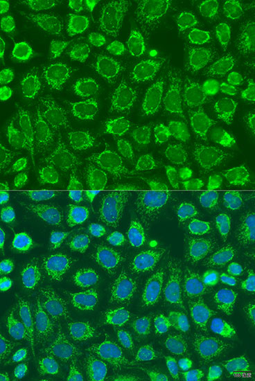 SNX32 Antibody in Immunocytochemistry (ICC/IF)