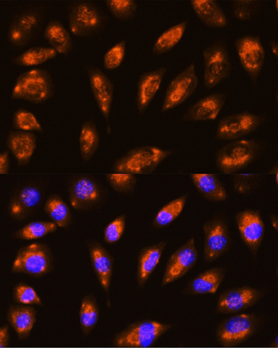 GRID1 Antibody in Immunocytochemistry (ICC/IF)