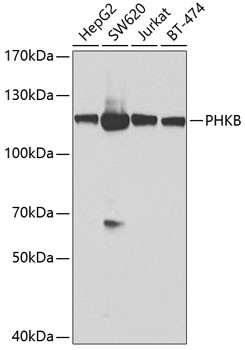 PHKB Antibody in Western Blot (WB)