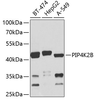 PIP4K2B Antibody in Western Blot (WB)
