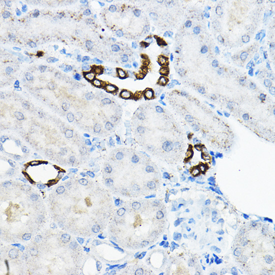 TMEM166 Antibody in Immunohistochemistry (Paraffin) (IHC (P))