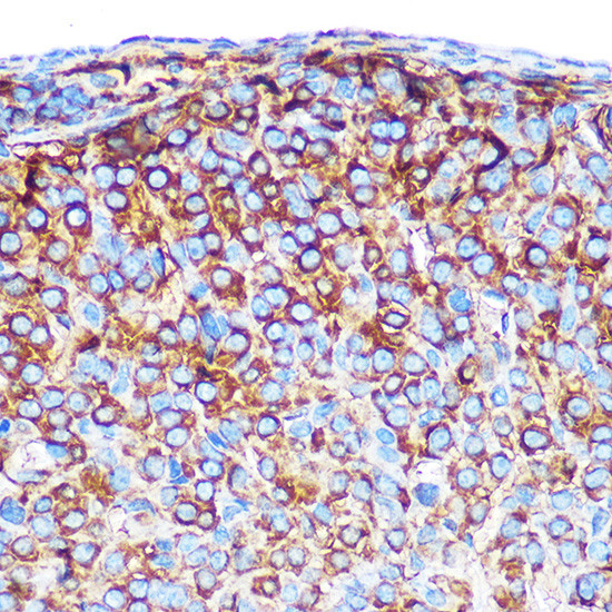 PRAMEF20 Antibody in Immunohistochemistry (Paraffin) (IHC (P))