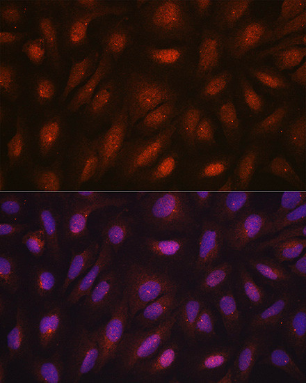 Centrin 3 Antibody in Immunocytochemistry (ICC/IF)