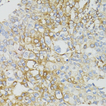 MT-ND5 Antibody in Immunohistochemistry (Paraffin) (IHC (P))