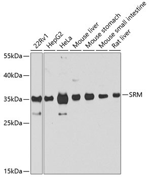 SRM Antibody in Western Blot (WB)
