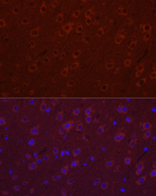 SYT11 Antibody in Immunocytochemistry (ICC/IF)