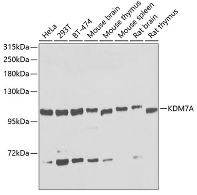 JHDM1D Antibody in Western Blot (WB)