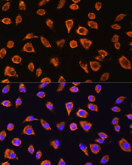 NOTCH4 Antibody in Immunocytochemistry (ICC/IF)