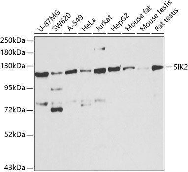 SIK2 Antibody in Western Blot (WB)