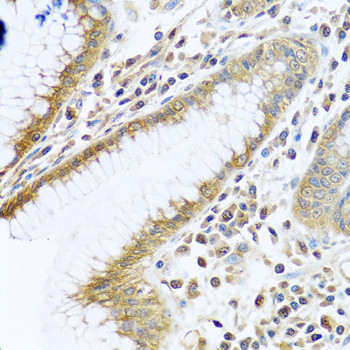 TMEM189 Antibody in Immunohistochemistry (Paraffin) (IHC (P))