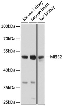 MEIS2 Antibody in Western Blot (WB)