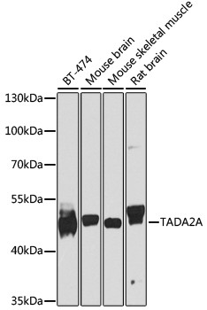 TADA2L Antibody in Western Blot (WB)